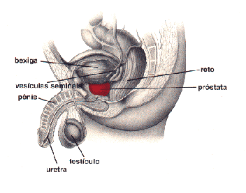nodulo na prostata benigno)